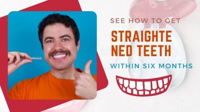 Photo of Straightened Teeth: See How To Get Straightened Teeth Within Six Months