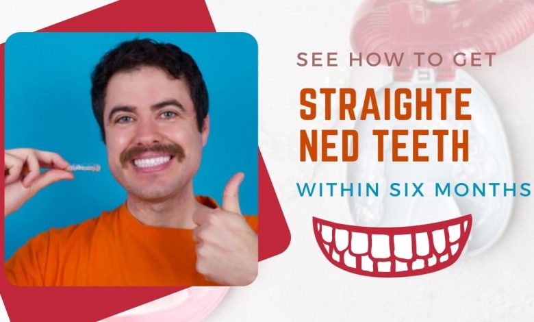 See How To Get Straightened Teeth Within Six Months