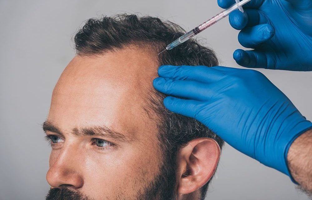 PRP treatment