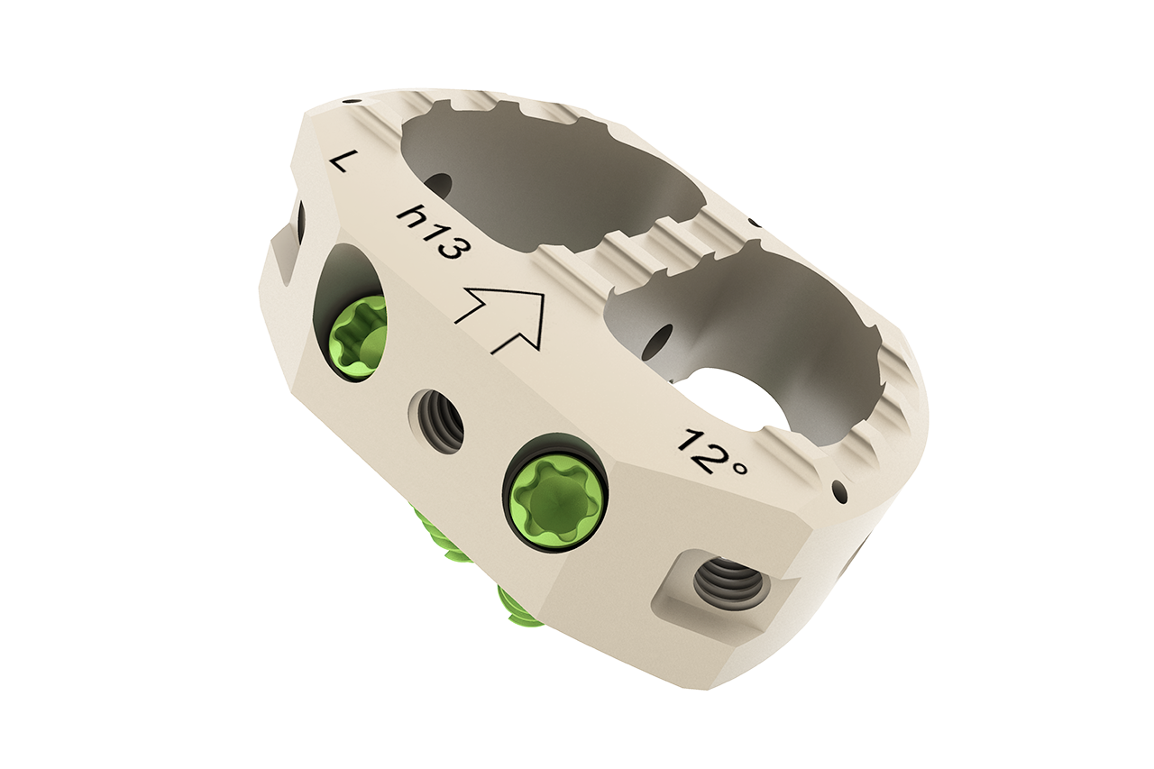 Lumbar Cage Design Concepts Based on Anterior Interbody Fusion