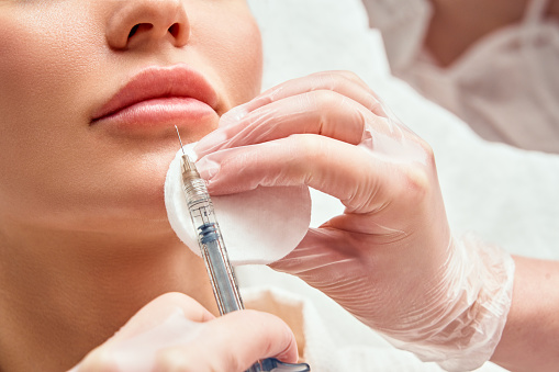 botox treatment