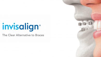 Photo of Pros and Cons of Invisalign