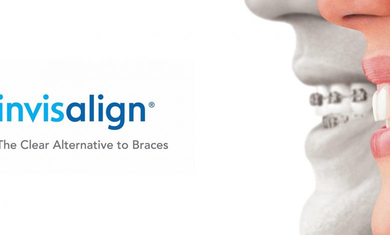 Invisalign