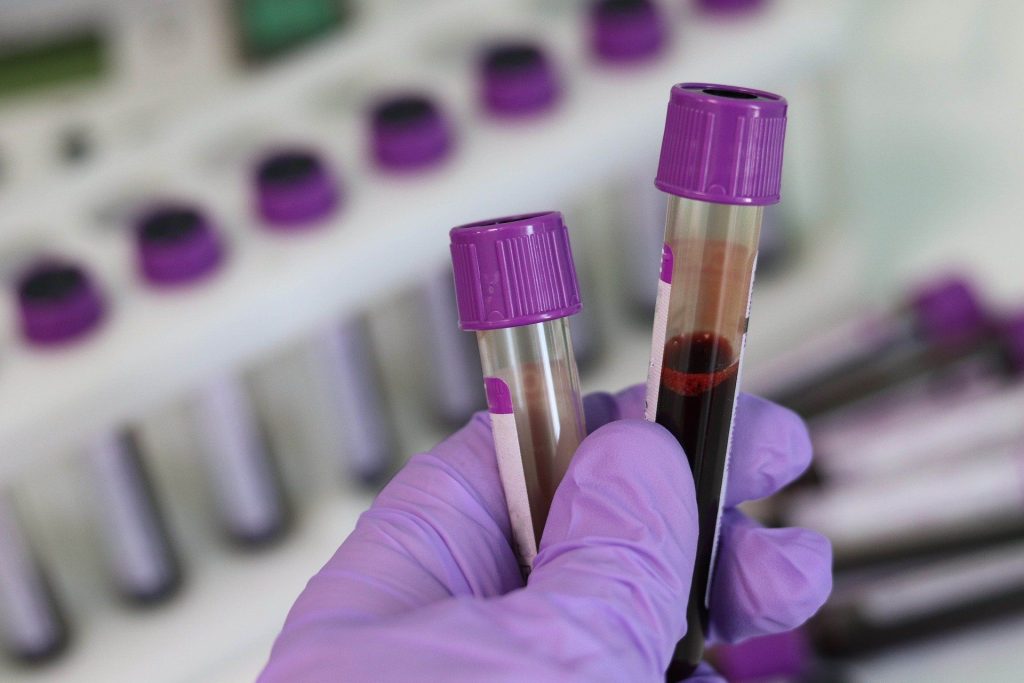 online blood test