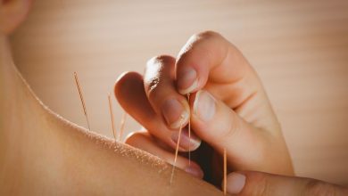 Photo of What are the benefits of acupuncture?