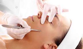 Photo of 4 Advantages Of Dermaplaning Facial Treatment