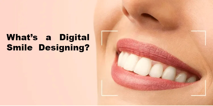 Digital Smile Designing