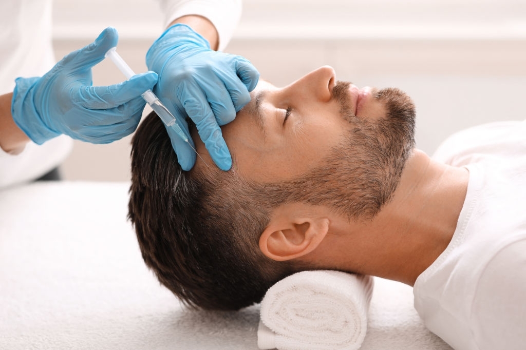hair transplant