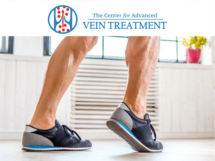 Spider Vein Treatment: What Is It And Why It Is Important?