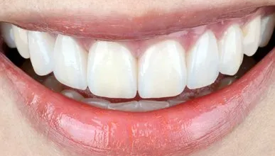 Photo of The Most Common Dental Treatment Is To Replace Teeth With Dentures