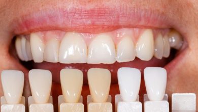 Photo of Dental Veneers: Things You Need To Know