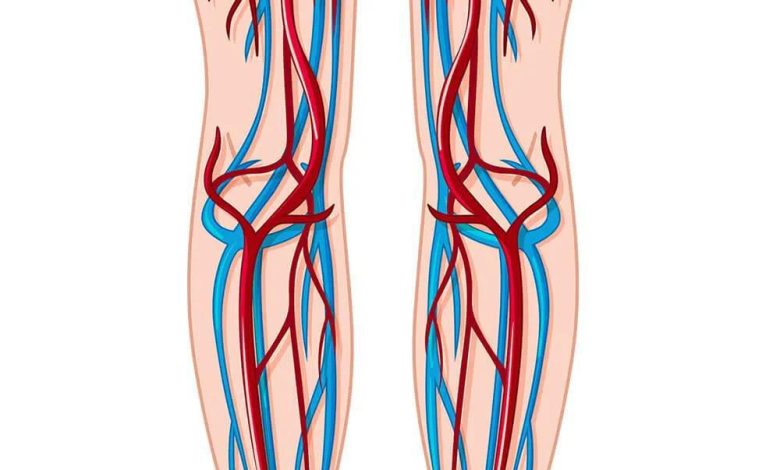 What Are the Most Effective Natural Spider Vein Treatments?