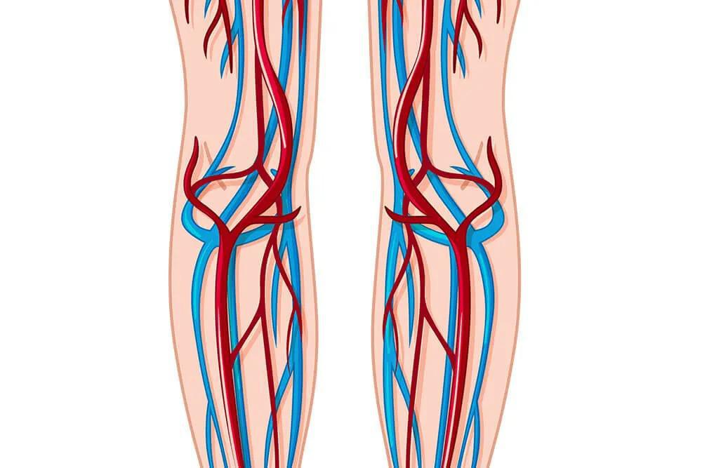 What Are the Most Effective Natural Spider Vein Treatments?