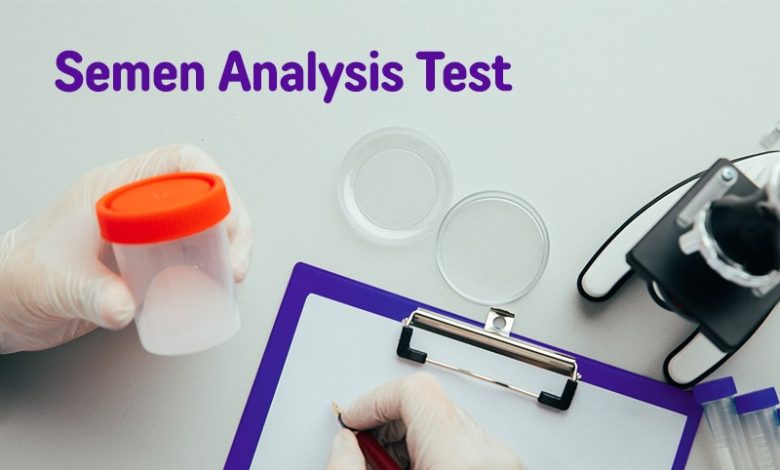 Semen-Analysis-Test-Banker-IVF