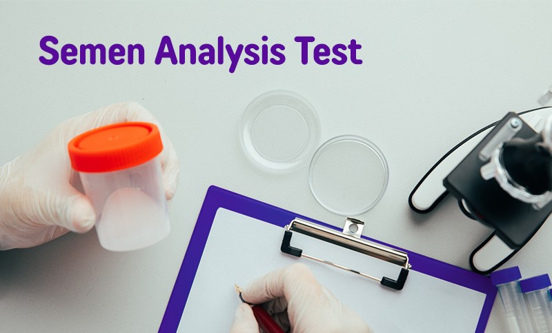 Semen Analysis Test All You Need To Know Dew Articles 