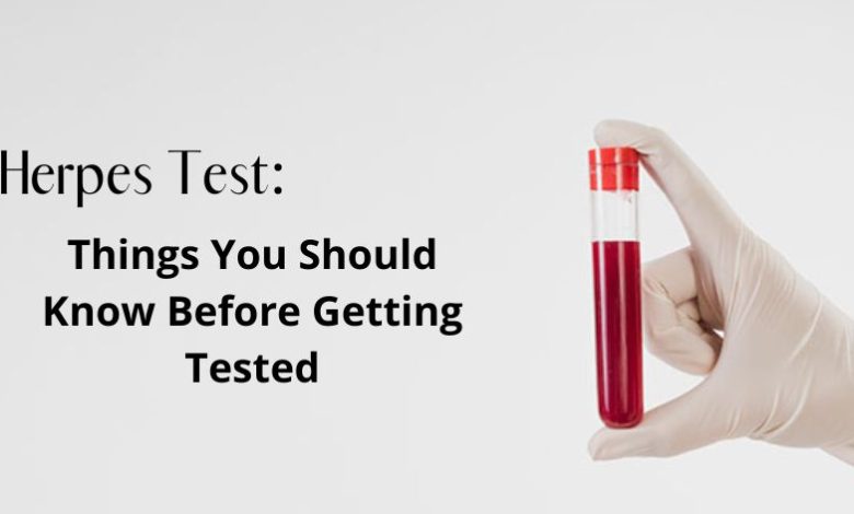 Herpes Test