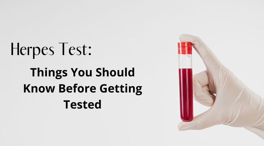 Herpes Test