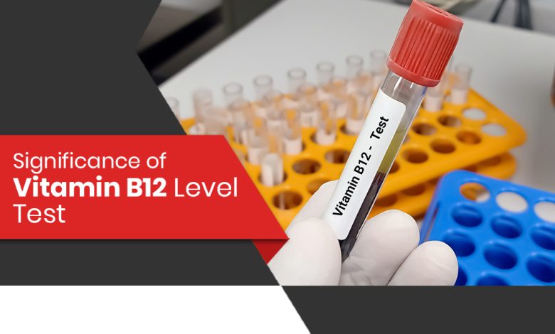 Significance of vitamin B12 level test