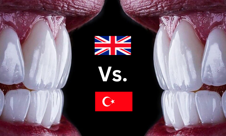 Veneers UK Vs Turkey