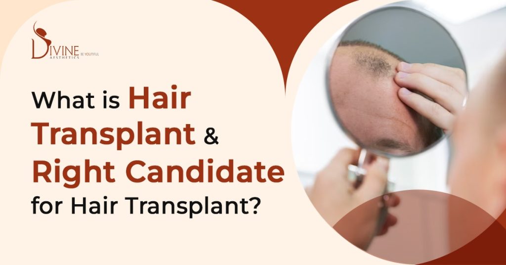 Hair Transplant