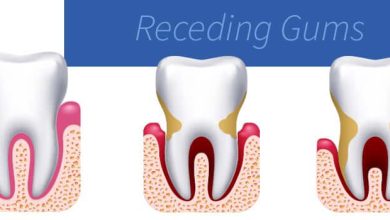 Photo of Restoring Receding Gums: Surgical and Natural Remedies Explored