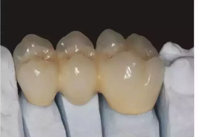 zirconia crowns