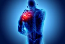 Photo of Why Does Your Shoulder Hurt After Exercise? Tips to Prevent Injury.